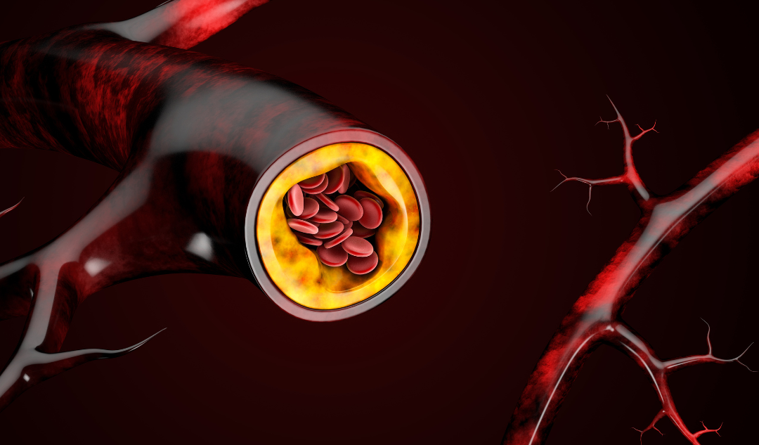 The Truth About Cholesterol